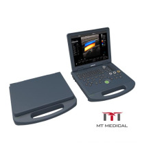 15 inch LCD Flat Screen Portable 3D 4D Color Doppler Ultrasound Scanner Machine